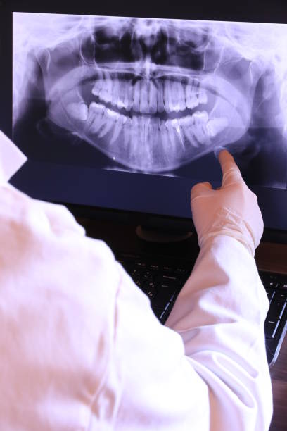 Best Knocked-Out Tooth Emergency  in East Foothills, CA