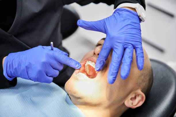 Best Teeth Whitening  in East Foothills, CA